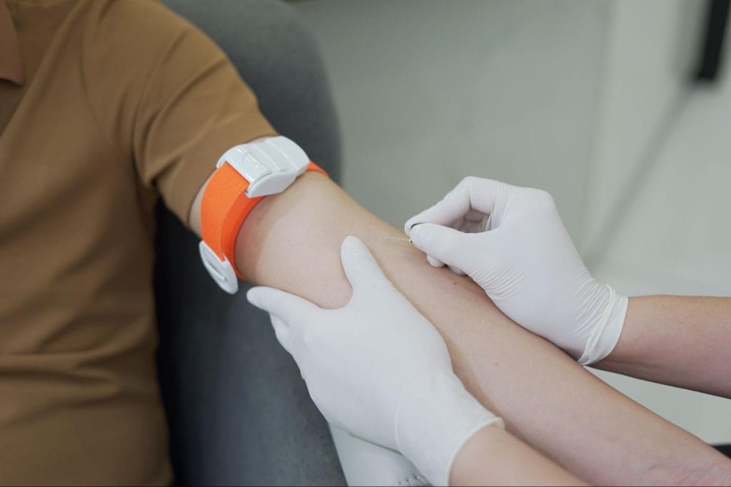 Lấy máu là một bước trong quy trình xét nghiệm RF