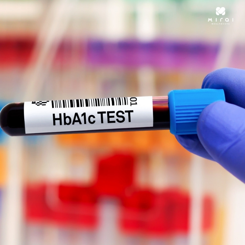 hba1c-la-gi-chi-so-hba1c-bao-nhieu-la-bi-tieu-duong