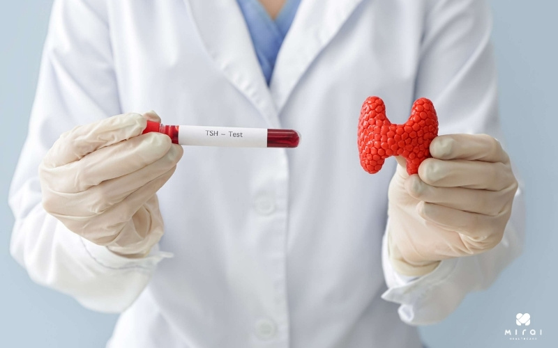 tsh-cao-cho-thay-tuyen-giap-hoat-dong-kem