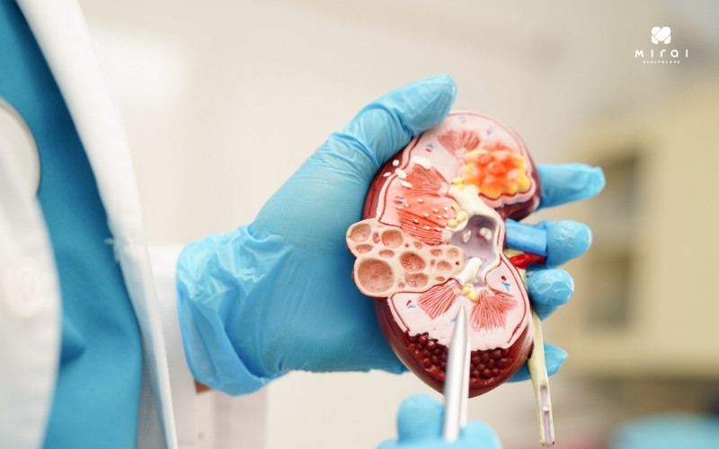 xet-nghiem-acid-uric-khi-nghi-ngo-suy-giam-chuc-nang-than