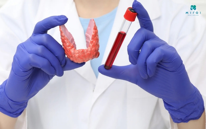 xet-nghiem-anti-tpo-chan-doan-tinh-trang-tuyen-giap