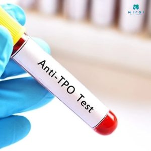 xet-nghiem-anti-tpo-trong-chan-doan-benh-tuyen-giap-tu-mien