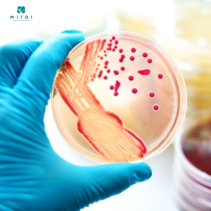 xet-nghiem-cay-mau-giup-phat-hien-nhiem-khuan-va-nam-vi-sinh