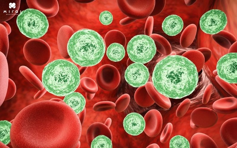 xet-nghiem-cay-mau-giup-phat-hien-nhiem-trung-huyet