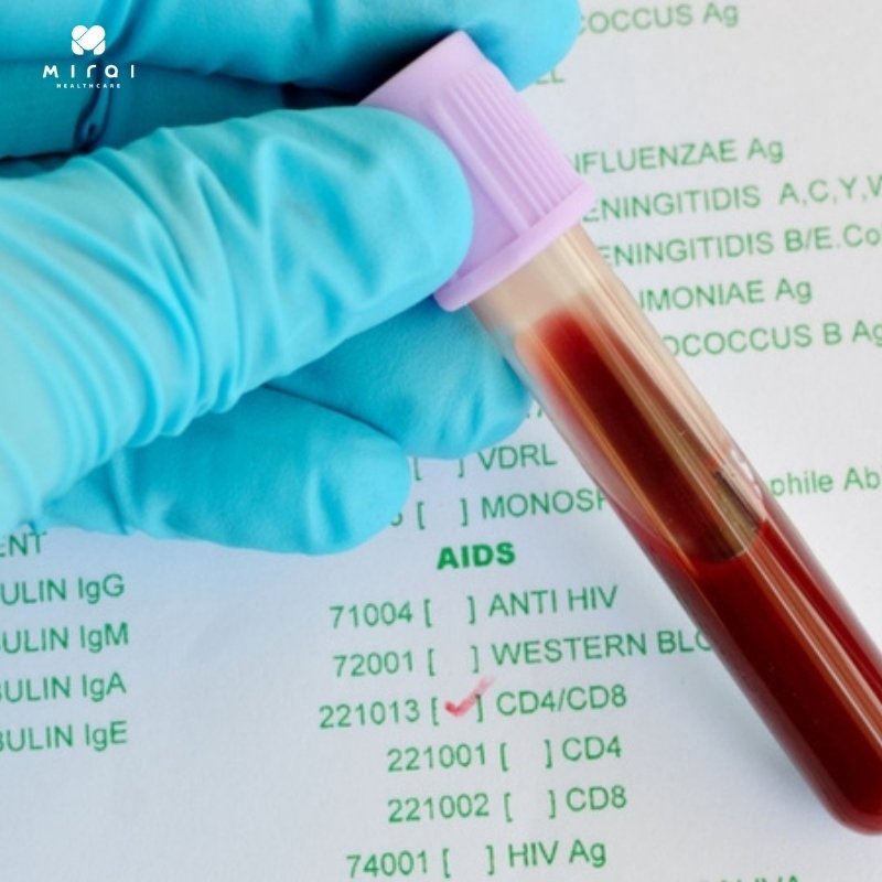 xet-nghiem-cd4-danh-gia-he-mien-dich-va-tinh-trang-nhiem-hiv