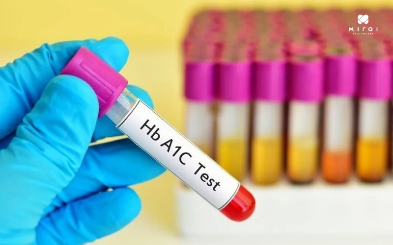 xet-nghiem-hba1c-de-phan-anh-muc-duong-huyet-trung-binh