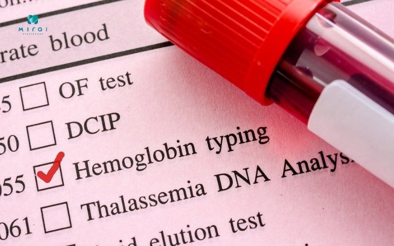 xet-nghiem-hgb-do-nong-do-huyet-sac-to-trong-mau