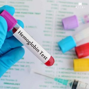 xet-nghiem-hgb-trong-mau-danh-gia-luong-huyet-sac-to