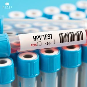 xet-nghiem-hpv-bao-lau-1-lan