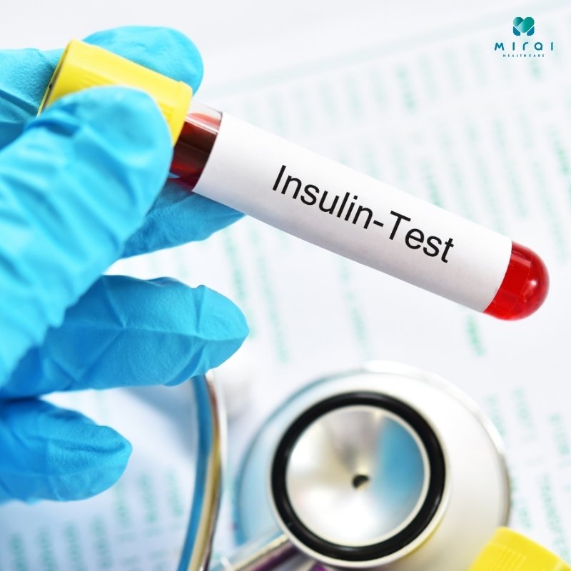 xet-nghiem-insulin-trong-chan-doan-tieu-duong-va-khang-insulin