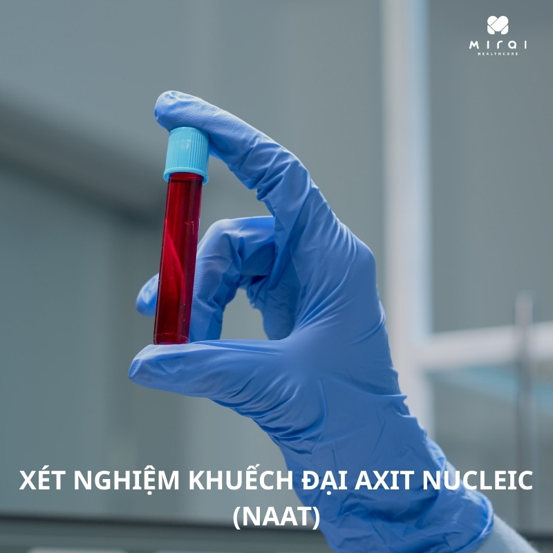 xet-nghiem-khuech-dai-axit-nucleic-naat-vi-khuan-virus