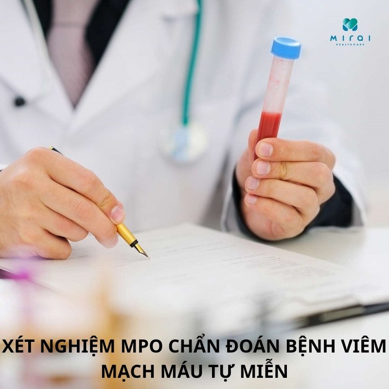 xet-nghiem-mpo-chan-doan-benh-viem-mach-mau-tu-mien