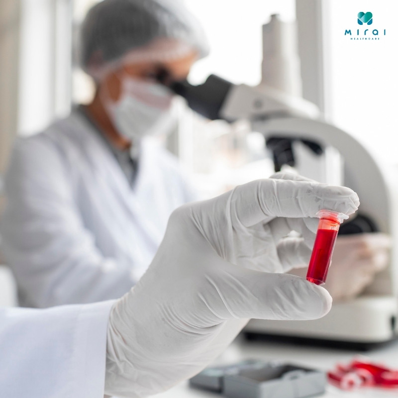 xet-nghiem-phet-mau-ngoai-bien-quan-sat-qua-kinh-hien-vi