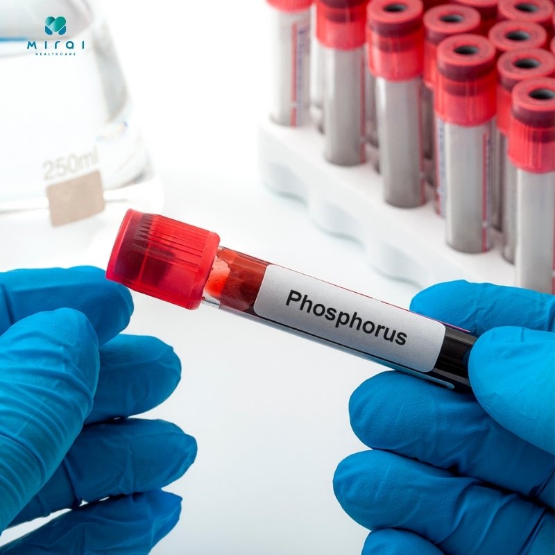 xet-nghiem-phospho-chan-doan-benh-ve-xuong-than-tuyen-giap