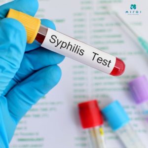xet-nghiem-syphilis-giup-phat-hien-som-benh-giang-mai