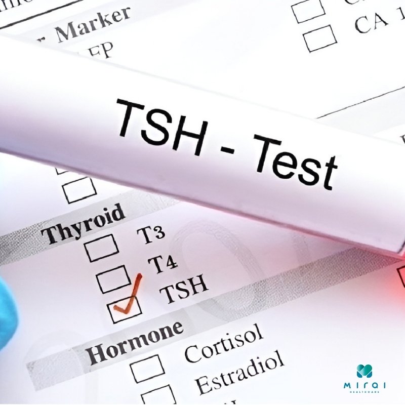 xet-nghiem-tsh-trong-chan-doan-benh-tuyen-giap