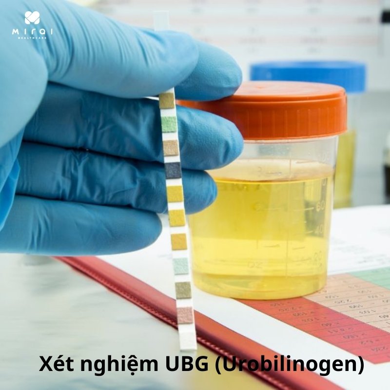 xet-nghiem-ubg-trong-chan-doan-benh-gan-va-mat