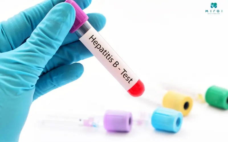 xet-nghiem-viem-gan-b-co-ket-qua-nhanh-khoang-2-3-gio-sau-lay-mau