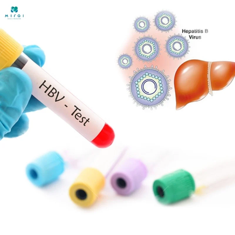 xet-nghiem-viem-gan-b