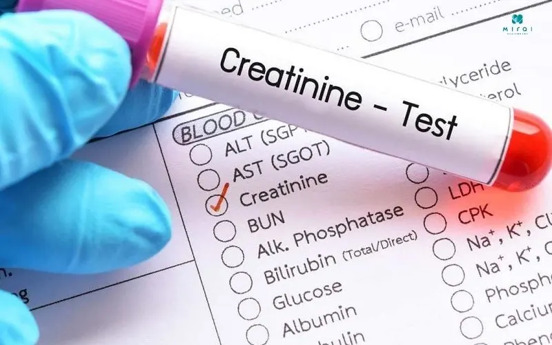 creatinin-la-chi-so-quan-trong-kiem-tra-chuc-nang-than