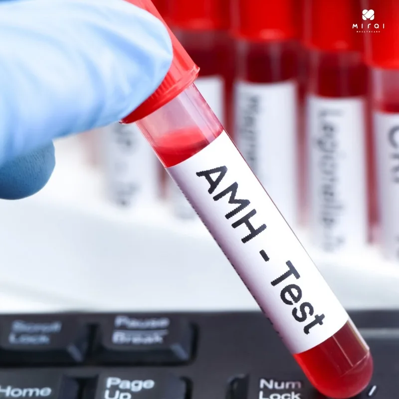 xet-nghiem-amh-gia-bao-nhieu