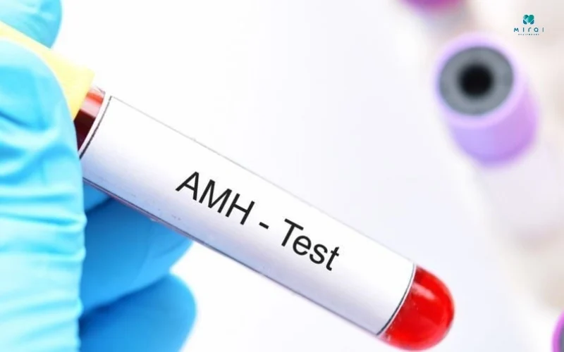 xet-nghiem-amh-khong-can-phai-nhin-an